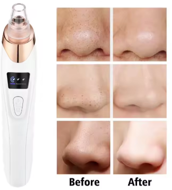 Nova Remover™ – Dybtgående porerensning uden irritation